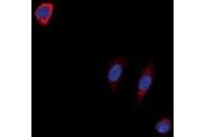 Immunofluorescent analysis of NTR1 staining in SKNSH cells.