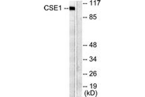 Western blot analysis of extracts from 293 cells, using CSE1L Antibody. (Exportin 2 Antikörper  (AA 1-50))
