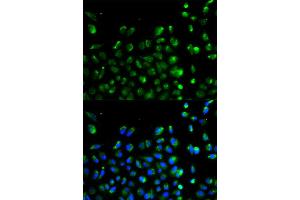 Immunofluorescence analysis of A549 cell using ATG13 antibody. (ATG13 Antikörper)