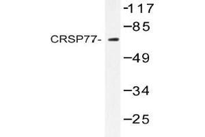 Western blot (WB) analysis of CRSP77 antibody in extracts from HT-29 cells. (MED17 Antikörper)