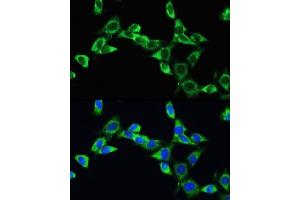 Immunofluorescence analysis of NIH/3T3 cells using VEGFA Rabbit pAb (ABIN6128907, ABIN6150083, ABIN6150084 and ABIN6215912) at dilution of 100 (40x lens). (VEGFA Antikörper  (AA 27-126))