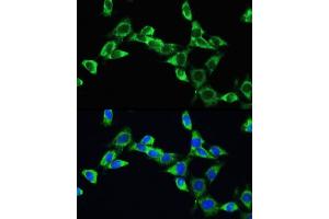 Immunofluorescence analysis of NIH/3T3 cells using VEGFA Rabbit pAb (ABIN6128907, ABIN6150083, ABIN6150084 and ABIN6215912) at dilution of 100 (40x lens).