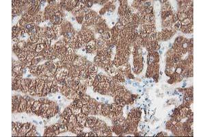 Immunohistochemical staining of paraffin-embedded Human liver tissue using anti-CYP2A6 mouse monoclonal antibody. (CYP2A6 Antikörper)