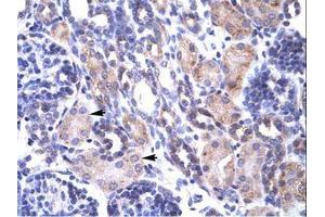 Image no. 1 for anti-TNF Receptor-Associated Protein 1 (TRAP1) (AA 41-90) antibody (ABIN202875) (TRAP1 Antikörper  (AA 41-90))