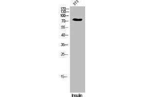 Western Blot analysis of 3T3 cells using Phospho-Gab 1 (Y659) Polyclonal Antibody (GAB1 Antikörper  (pTyr659))