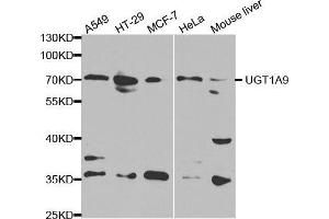 Western blot analysis of extracts of various cell lines, using UGT1A9 antibody. (UGT1A9 Antikörper  (AA 26-250))