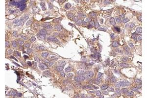 ABIN6267008 at 1/100 staining human Breast tissue sections by IHC-P.