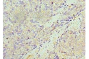 Immunohistochemistry (IHC) image for anti-Sulfotransferase Family, Cytosolic, 1A, Phenol-Preferring, Member 1 (SULT1A1) (AA 1-295) antibody (ABIN7170948)