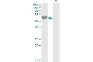 Nemo-Like Kinase Antikörper  (AA 416-515)