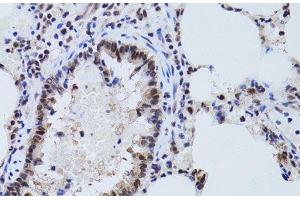 Immunohistochemistry of paraffin-embedded Rat lung using SIRT7 Polyclonal Antibody at dilution of 1:100 (40x lens). (SIRT7 Antikörper)