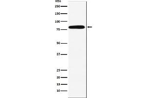 Western blot analysis of Calpain 2 expression in A431 cell lysate. (Rekombinanter Calpain 2 Antikörper)