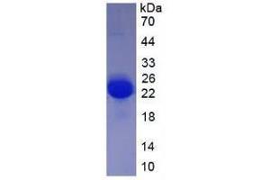 Image no. 2 for Vascular Endothelial Growth Factor A (VEGFA) (AA 27-190) (Active) protein (His tag) (ABIN6239764) (VEGFA Protein (AA 27-190) (His tag))