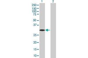 Western Blot analysis of RNF32 expression in transfected 293T cell line ( H00140545-T02 ) by RNF32 MaxPab polyclonal antibody. (RNF32 Antikörper  (AA 1-256))