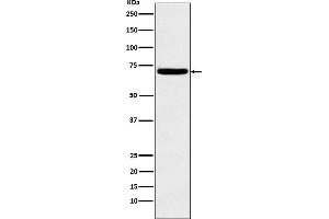 Western blot analysis of Heparanase 1 expression in K562 cell lysate.