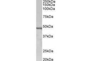 Image no. 1 for anti-Chitotriosidase (CHIT1) (AA 409-423) antibody (ABIN1100790) (Chitotriosidase 1 Antikörper  (AA 409-423))