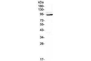 Western blot testing of rat thymus lysate with Ptpn22 antibody at 0. (PTPN22 Antikörper)