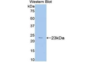 Western blot analysis of the recombinant protein. (VEGFA Antikörper  (AA 27-190))