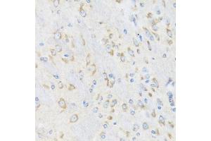 Immunohistochemistry of paraffin-embedded mouse brain using CHIC2 antibody (ABIN6130103, ABIN6138533, ABIN6138534 and ABIN6223980) at dilution of 1:100 (40x lens). (CHIC2 Antikörper  (AA 1-165))
