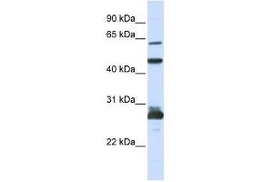 PES1 antibody used at 1 ug/ml to detect target protein. (PES1 Antikörper)