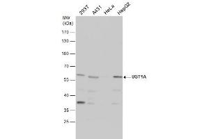 WB Image UGT1A antibody detects UGT1A protein by western blot analysis. (Ugt1 Antikörper)