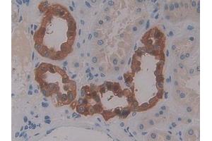 DAB staining on IHC-P; Samples: Human Kidney Tissue (CCL13 Antikörper  (AA 24-98))