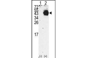 Western blot analysis of PDX1 (arrow) using rabbit polyclonal PDX1 Antibody (N-term) (R). (PDX1 Antikörper  (N-Term))