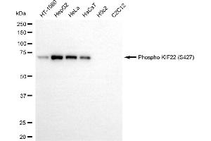 Western blotting analysis using phospho-KIF22 (S427) antibody (ABIN7799202). (Rekombinanter KIF22 Antikörper  (pSer427))