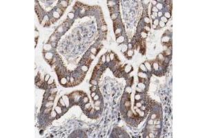 Immunohistochemical staining of human small intestine with SETD3 polyclonal antibody  shows strong cytoplasmic positivity with a granular pattern in glandular cells at 1:50-1:200 dilution.
