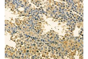 p23 Mouse Monoclonal Antibody at 1/100 staining mouse testis tissue by IHC-P. (CDK5R1 Antikörper)
