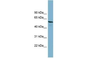 WB Suggested Anti-PGM3  Antibody Titration: 0. (Phosphoglucomutase 3 Antikörper  (Middle Region))