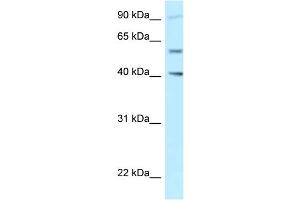 WB Suggested Anti-SHCBP1L Antibody Titration: 1. (SHCBP1L Antikörper  (C-Term))