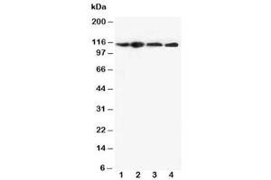 Western Blotting (WB) image for anti-NLR Family, Pyrin Domain Containing 3 (NLRP3) (N-Term) antibody (ABIN3032021)