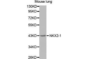 Western Blotting (WB) image for anti-NK2 Homeobox 1 (NKX2-1) antibody (ABIN1681058) (NKX2-1 Antikörper)