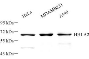 Western blot analysis of HHLA2 (ABIN7074199) at dilution of 1: 300 (HHLA2 Antikörper)