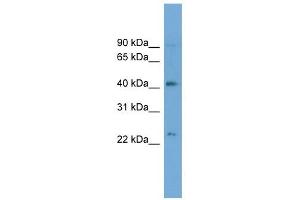 ATP8B2 antibody used at 1 ug/ml to detect target protein. (ATP8B2 Antikörper  (N-Term))
