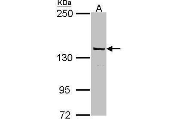 POLG Antikörper  (C-Term)