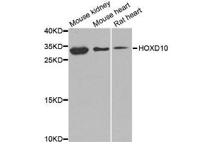 Western blot analysis of extracts of various cell lines, using HOXD10 antibody (ABIN5974761) at 1/1000 dilution. (HOXD10 Antikörper)