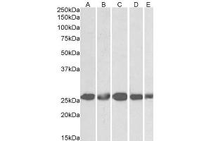ABIN5539633 (1µg/ml) staining of NIH3T3 (A), HeLa (B), K562 (C), MCF7 (D) and HepG2 (E) lysates (35µg protein in RIPA buffer). (CSNK2B Antikörper  (Internal Region))