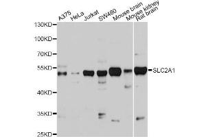 Western blot analysis of extracts of various cell lines, using SLC2A1 antibody (ABIN5975456) at 1/1000 dilution. (GLUT1 Antikörper)