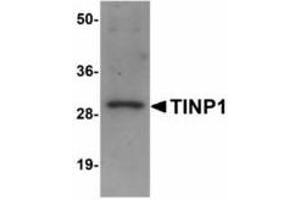 Image no. 1 for anti-NSA2 Ribosome Biogenesis Homolog (NSA2) (C-Term) antibody (ABIN478277) (NSA2 Antikörper  (C-Term))