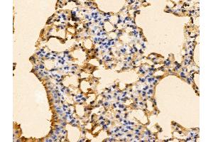 ABIN7094696 and ABIN7098747 at 1/100 staining Mouse lung tissue by IHC-P.
