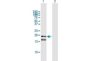 Western Blot analysis of GP9 expression in transfected 293T cell line by GP9 MaxPab polyclonal antibody. (CD42a Antikörper  (AA 1-177))