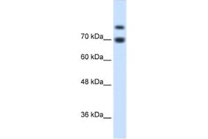 Western Blotting (WB) image for anti-Homeodomain Interacting Protein Kinase 2 (HIPK2) antibody (ABIN2460508) (HIPK2 Antikörper)