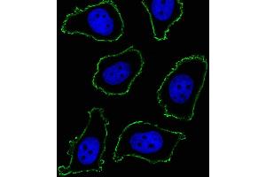 Fluorescent image of A549 cell stained with CD33 Antibody (ABIN1540002 and ABIN2843889)/SM120504AC. (CD33 Antikörper  (AA 337-364))