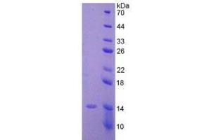 SDS-PAGE (SDS) image for Anti-Mullerian Hormone (AMH) ELISA Kit (ABIN6574075)