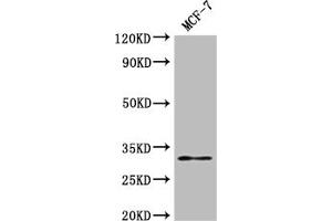 Western Blot Positive WB detected in: MCF-7 whole cell lysate All lanes: RSPH9 antibody at 1:2000 Secondary Goat polyclonal to rabbit IgG at 1/50000 dilution Predicted band size: 32, 35 kDa Observed band size: 32 kDa (RSPH9 Antikörper  (AA 62-171))