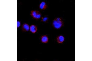 IF analysis of CD74 using anti-CD74 antibody (ABIN7603166). (CD74 Antikörper  (N-Term))