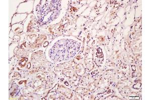 Immunohistochemistry (IHC) image for anti-Wingless-Type MMTV Integration Site Family, Member 4 (WNT4) (AA 201-300) antibody (ABIN762911)