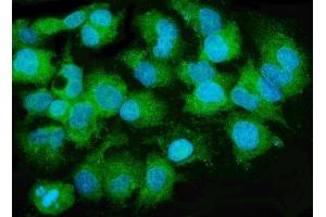 IF analysis of MTTP using anti-MTTP antibody (ABIN7601145).