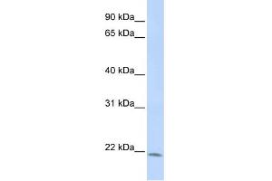 WB Suggested Anti-LIN7C Antibody Titration:  1 ug/ml  Positive Control:  HepG2 cell lysate (LIN7C Antikörper  (N-Term))
